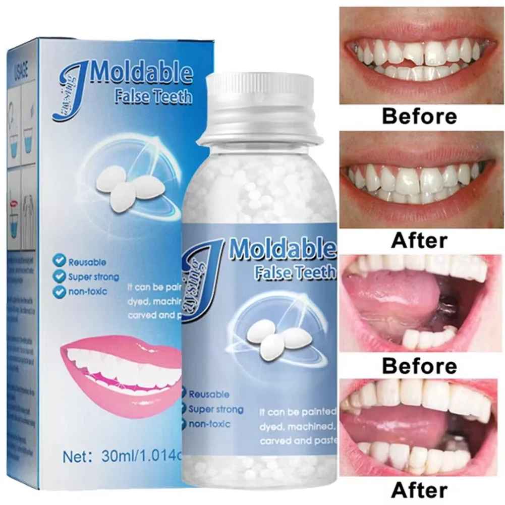 TeethRepair™ 1+1 GRATIS: Naturlig-utseende tannreparasjonssett