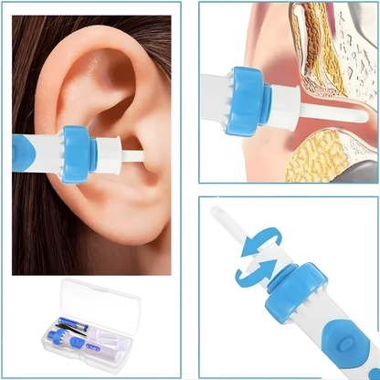 EarCleaner 1+1 GRATIS: Skånsom Rengøring Bærbar Sug Og Vakuum Øre Renser Værktøj