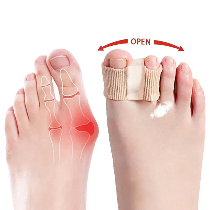 ToeSeparators: Premium Tåseparatorer For Komfortabel Tåjustering