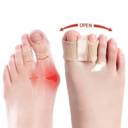 ToeSeparators: Premium Tåseparatorer For Komfortabel Tåjustering
