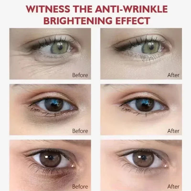 EyeCream 1+1 GRATIS: Fuktighetsgivende Oppstrammende Anti-Mørke Ringer Øyekrem Serum