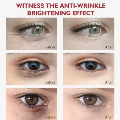 EyeCream 1+1 GRATIS: Fuktighetsgivende Oppstrammende Anti-Mørke Ringer Øyekrem Serum