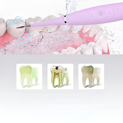 Cleaner Pro° DentalCleaner: Professionel Tandsten Fjerner Tænder Rengøring Sæt