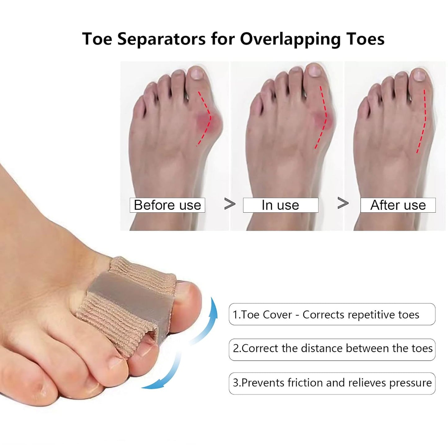 ToeSeparators: Premium Tåseparatorer For Komfortabel Tåjustering