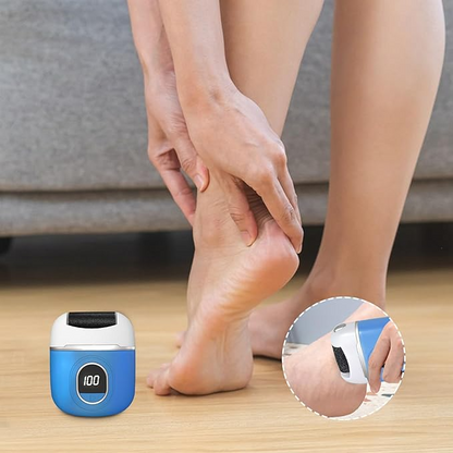 FootGrinder: Genopladelig Kompakt Døde Hud Fjernelse Fodsliber