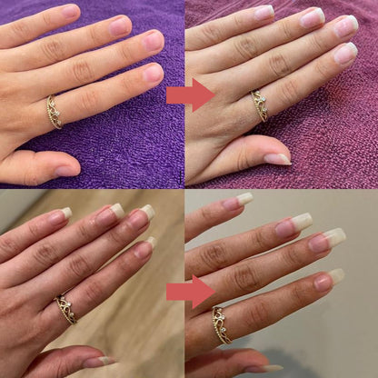 NailOil - Forsterkende Og Lysnende Vekstolje Til Negler
