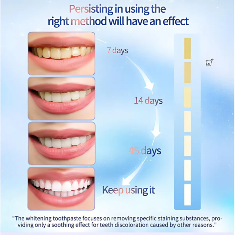 WhiteningToothpaste 1+1 GRATIS: Niacinamid-tannkrem For Bleking Og Fjerning Av Flekker