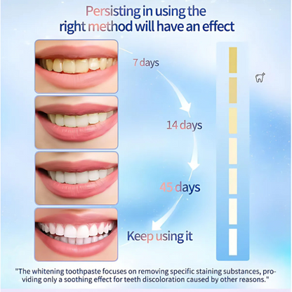 WhiteningToothpaste 1+1 GRATIS: Niacinamid-tannkrem For Bleking Og Fjerning Av Flekker