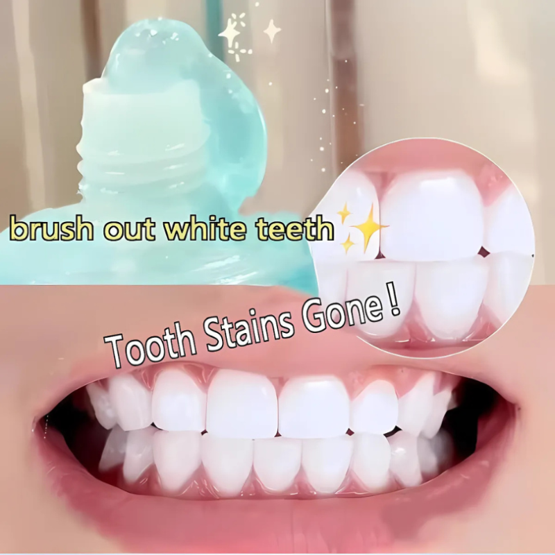 WhiteningToothpaste 1+1 GRATIS: Niacinamid-tannkrem For Bleking Og Fjerning Av Flekker