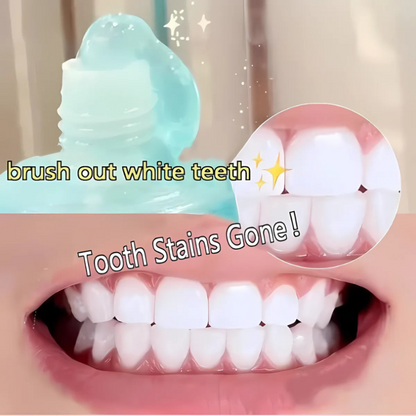 WhiteningToothpaste 1+1 GRATIS: Niacinamid-tannkrem For Bleking Og Fjerning Av Flekker