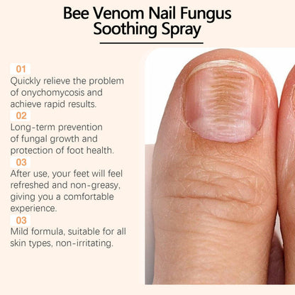 NailSpray 1+1 GRATIS - Nem At Bruge Beroligende Støtte Nail Care Repair Spray