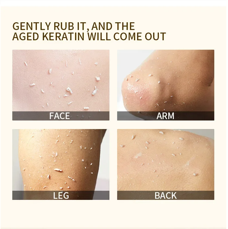 ExfoliatingGel 1+1 GRATIS: Oransje Eksfolierende Gel Mild Død Hud Fjerner