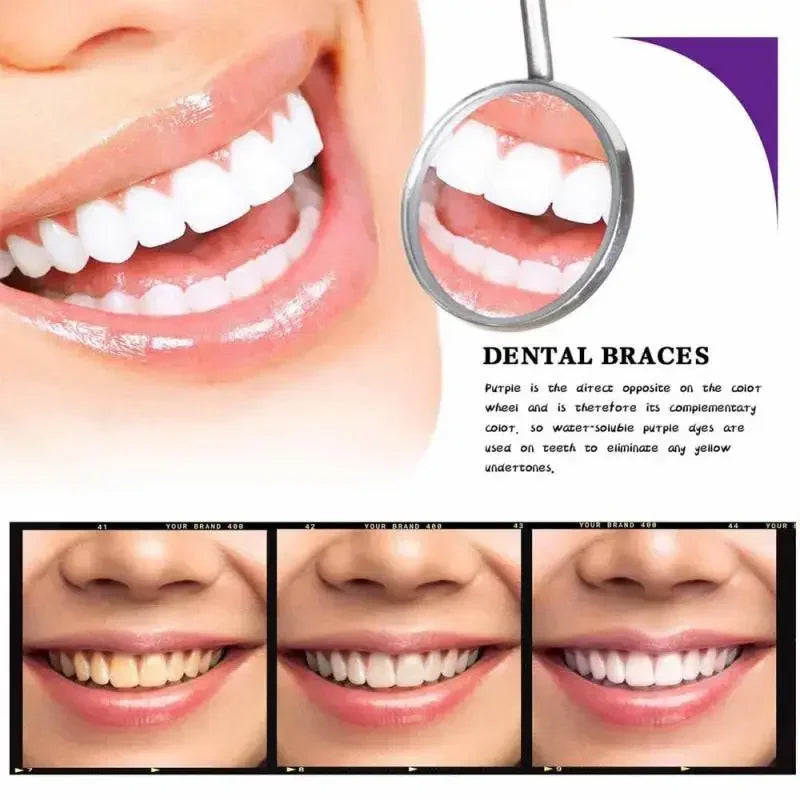 TeethSerum 1+1 GRATIS - Tannbleking Og Beskyttelsesserum