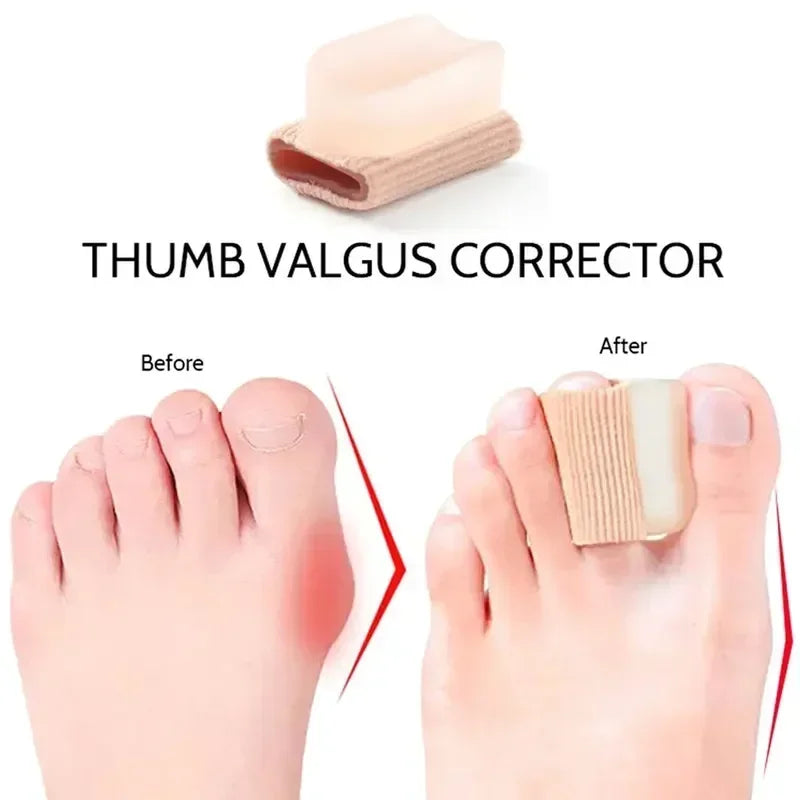 ToeSeparators: Premium Tåseparatorer For Komfortabel Tåjustering
