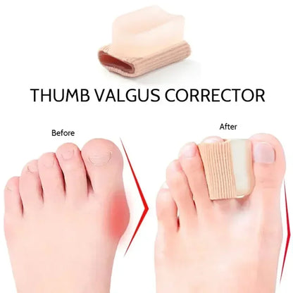 ToeSeparators: Premium Tåseparatorer For Komfortabel Tåjustering