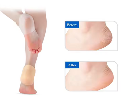 Happy™ HeelProtector 1+1 GRATIS - Myk Silikon Hælbeskytter