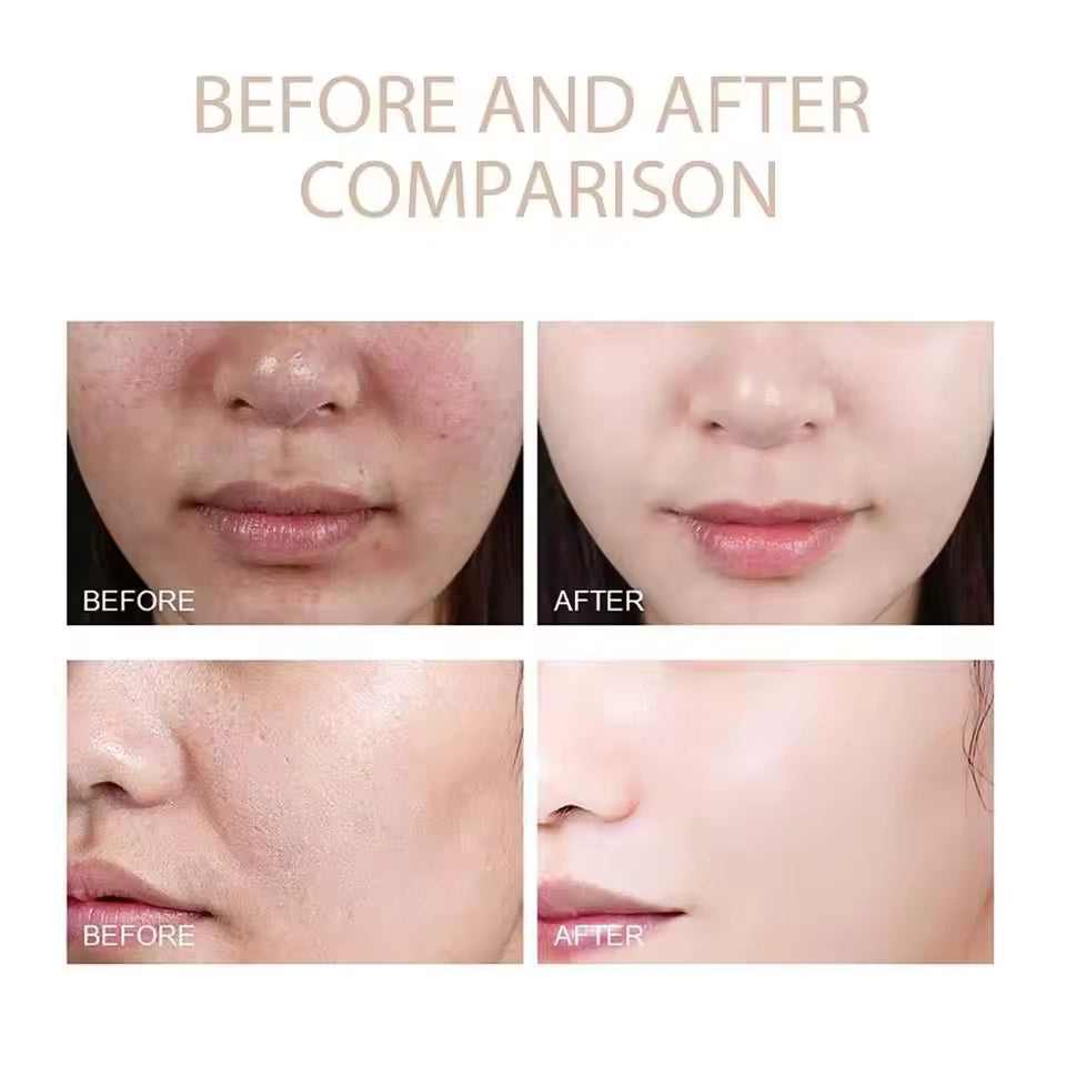 ExfoliatingSerum 1+1 GRATIS: Enkel Å Bruke Mild Eksfolierende Ampull For Sensitiv Hud