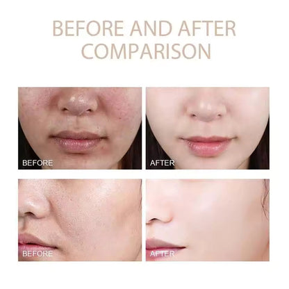 ExfoliatingSerum 1+1 GRATIS: Enkel Å Bruke Mild Eksfolierende Ampull For Sensitiv Hud