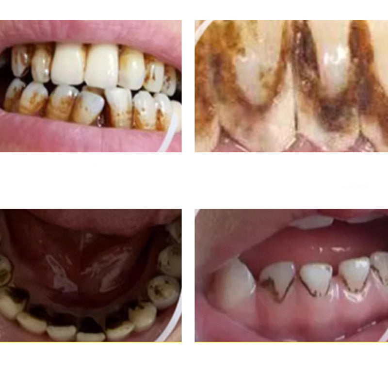 DentalCare – Enkelt 360° Tannpleieverktøysett Hjemme